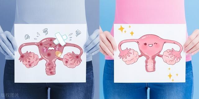 女性陰挺是怎么回事？對身體健康有影響嗎？需要治療嗎？