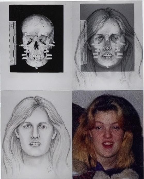 解剖者说|嘴最大的女人,人体解剖的神经系统…