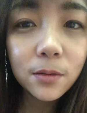 女生長胡子(女子感染新冠燒退了，卻長出了胡子，前后判若兩人)